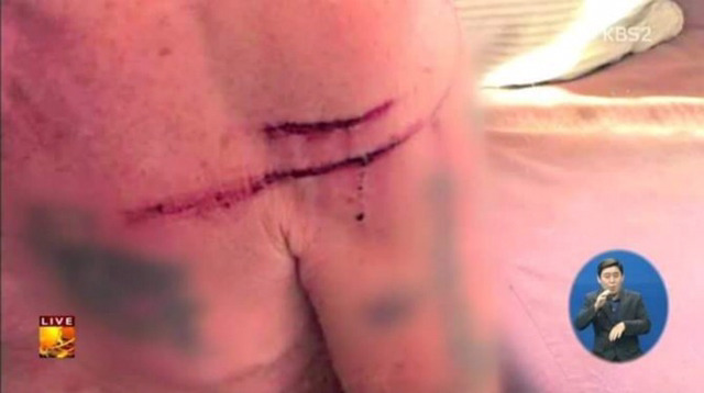 곰의 습격을 받은 할아버지.jpg | 인스티즈