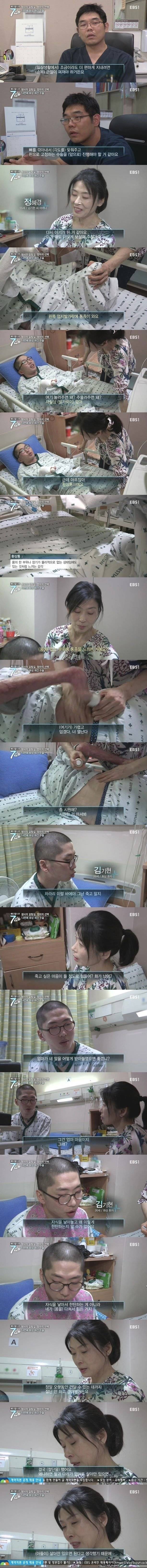 화상 환자들이 겪는 고통.jpg | 인스티즈