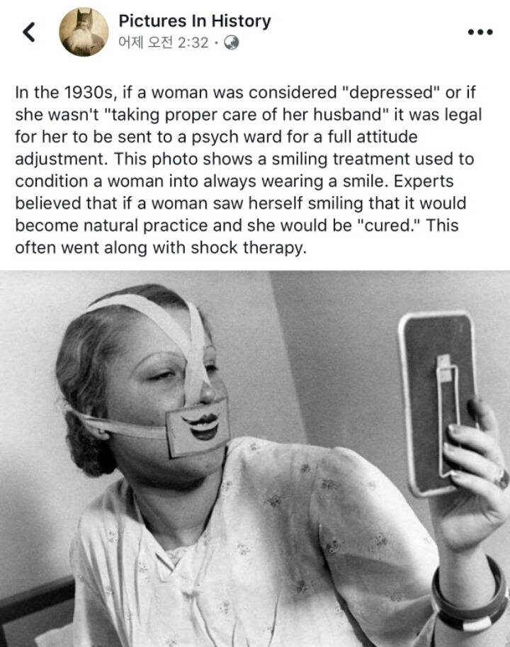 1930년대에 실행되었던 미소 치료법 | 인스티즈