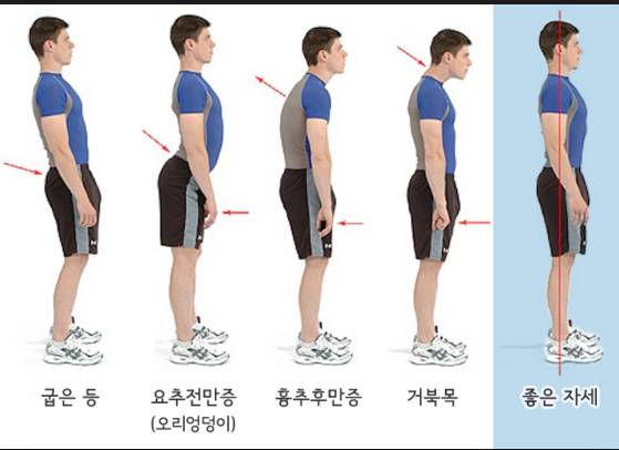 어렸을 때 관리 안 해서 제일 후회하는 것은? | 인스티즈
