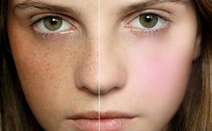 어렸을 때 관리 안 해서 제일 후회하는 것은? | 인스티즈