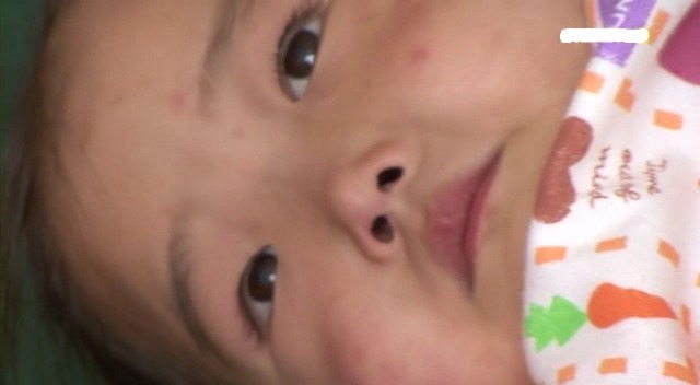 [MBC다큐] 북한으로 간 남한 의사들.JPG | 인스티즈