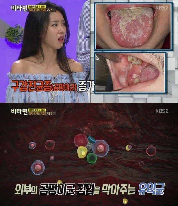 가글의 위험성.jpg | 인스티즈