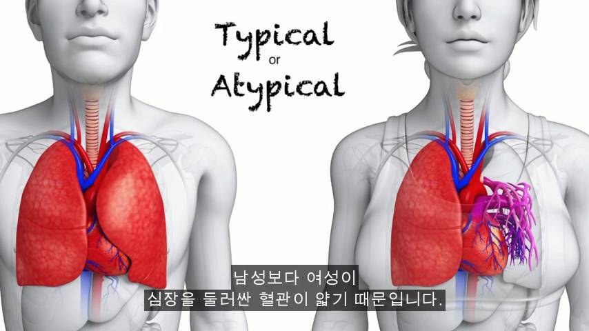 [TED] 왜 약은 종종 여성에게 위험한 부작용이 있는가 | 인스티즈