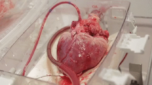 멍떄리고 보게 되는 심장의 박동 실제 모습 (혐오주의) | 인스티즈