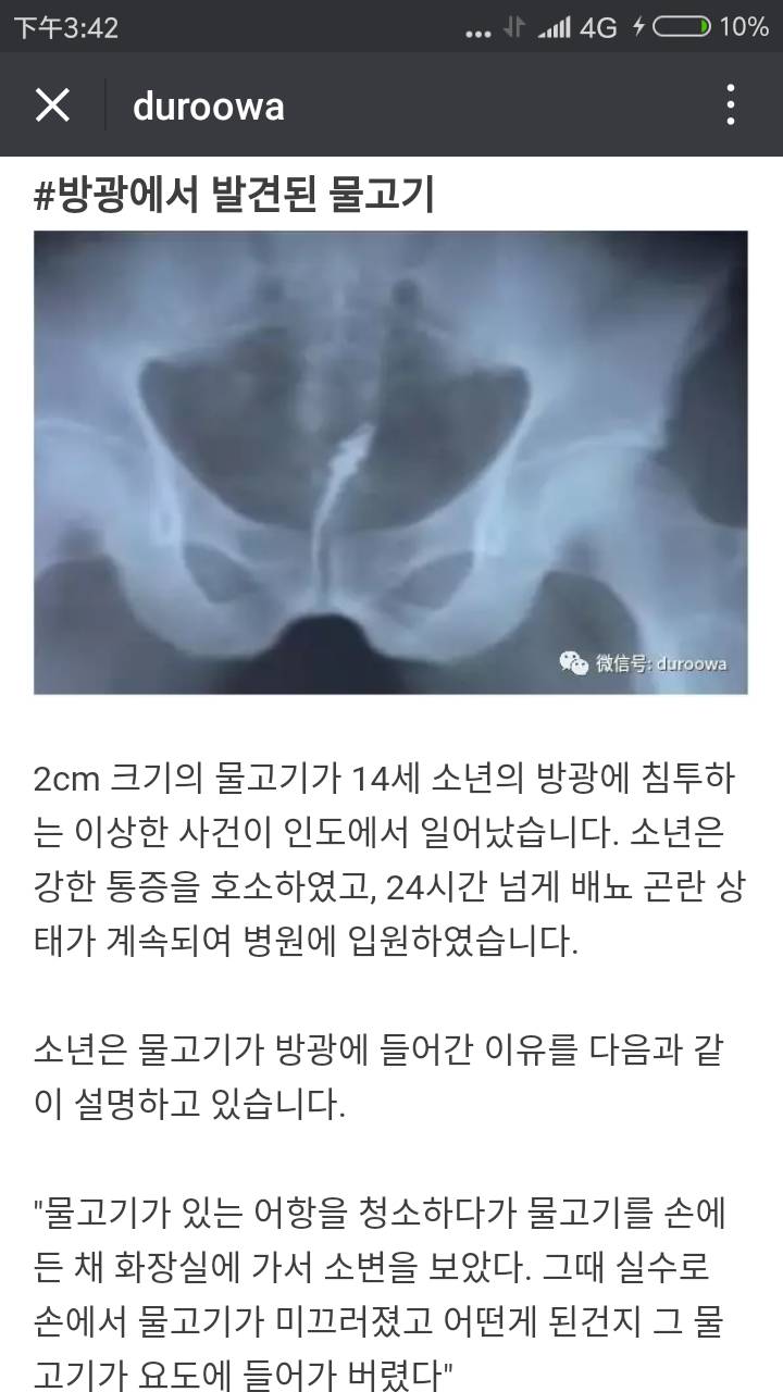 몸에서 나온 생명체들 (혐오주의) | 인스티즈