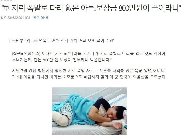 군인의 다리 | 인스티즈