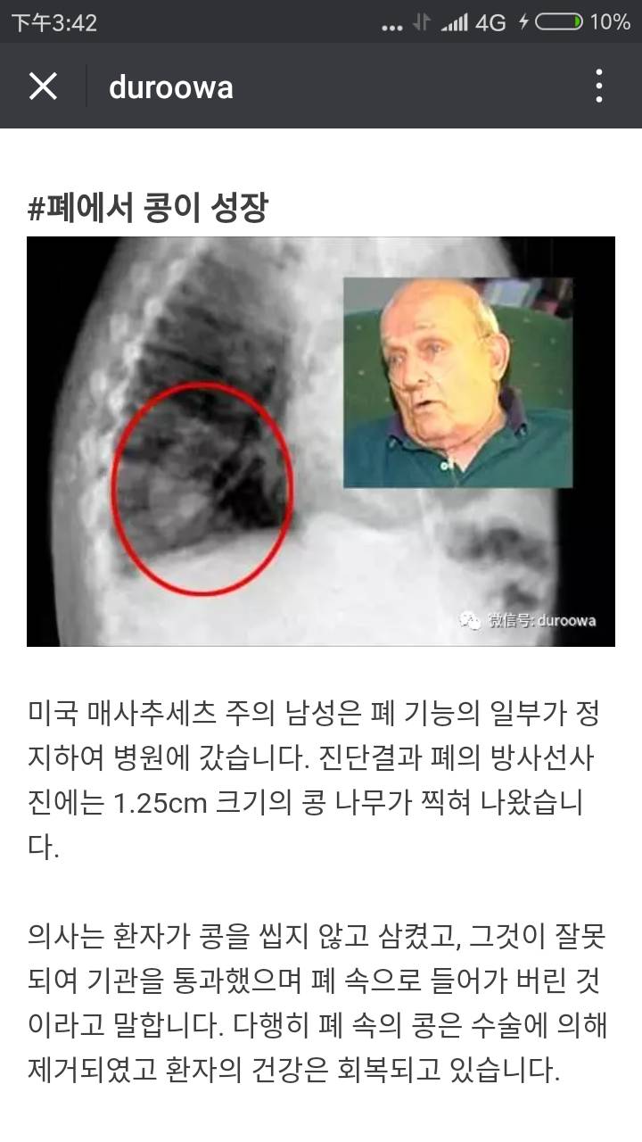 몸에서 나온 생명체들 (혐오주의) | 인스티즈