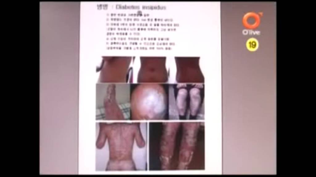 불치병에 걸린 남자친구.jpg | 인스티즈