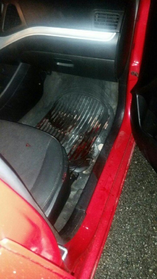 차 밖으로 몸 내밀고 포즈 취하다 사고당한 사람 | 인스티즈