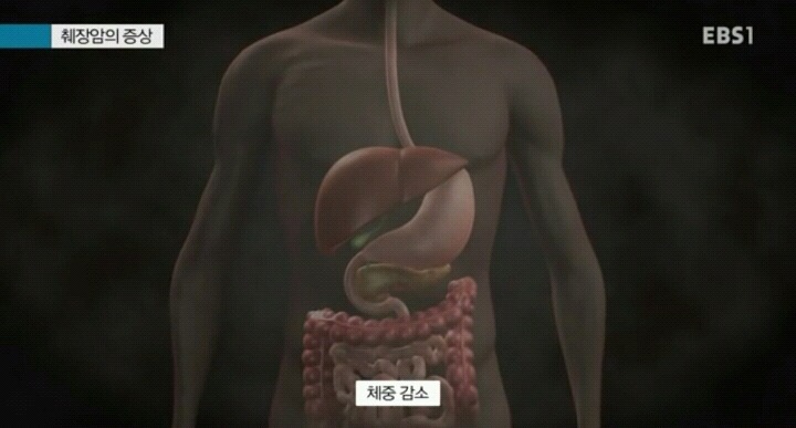 어떤병이 의심되서 증상찾아볼때 급안심되는 사항 | 인스티즈