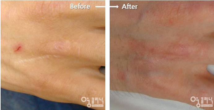 손나은 | 인스티즈