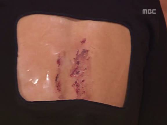 [거침없이하이킥] 민호보다 더 크게 다쳤는데 사람들이 몰라줘서 억울한 윤호.jpg | 인스티즈