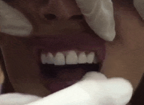 연예인 치아의 비밀 | 인스티즈