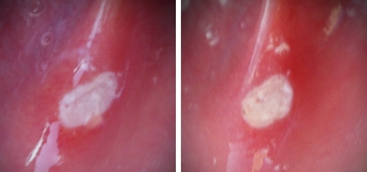 아프다vs참을만하다 | 인스티즈