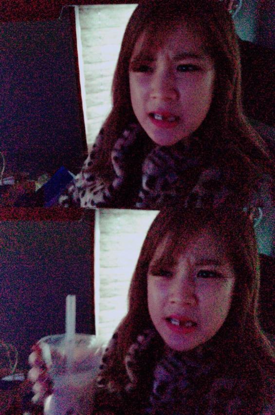 에이핑크 초롱이 앞니ㅠㅠㅜ | 인스티즈