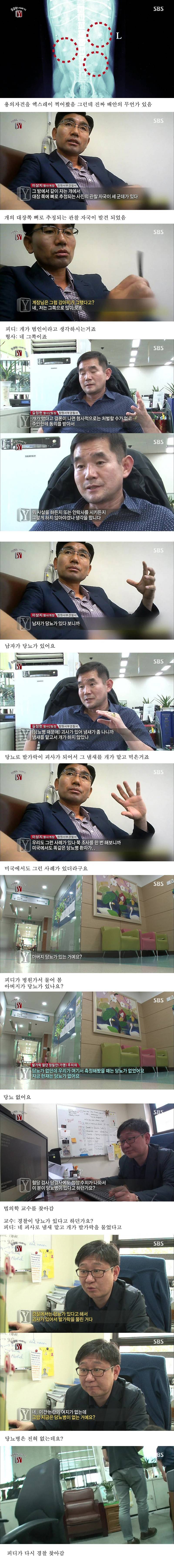 자고 일어났더니 사라진 발가락 (혐오주의) | 인스티즈