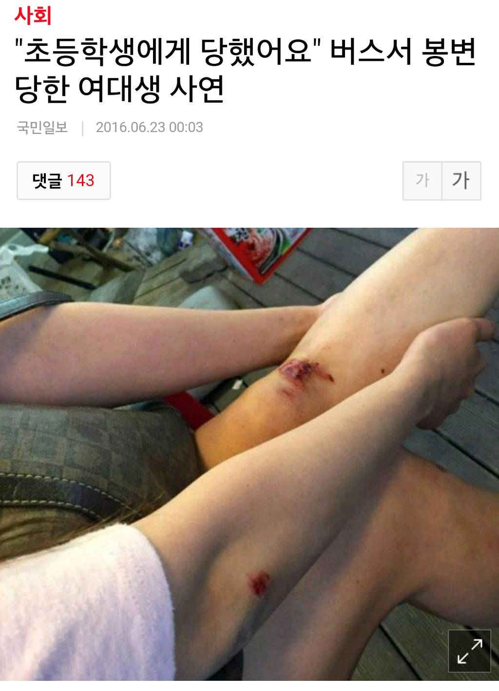 개념없는 초등학생때문에 다쳤어요 ㅠ | 인스티즈