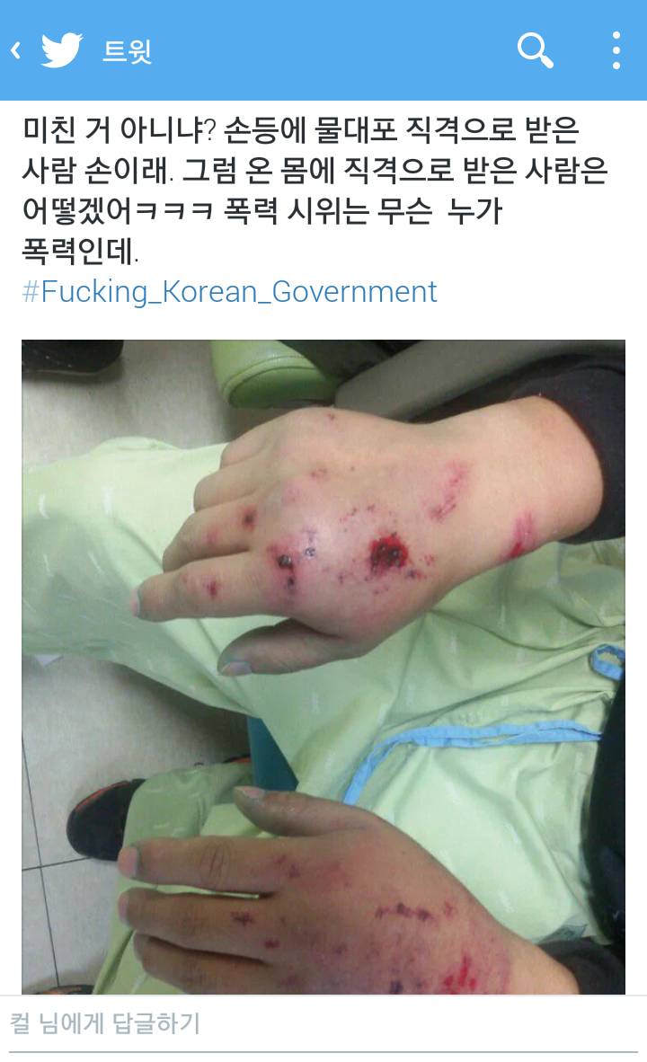 물대포 직격으로 맞은 사람의 손 | 인스티즈