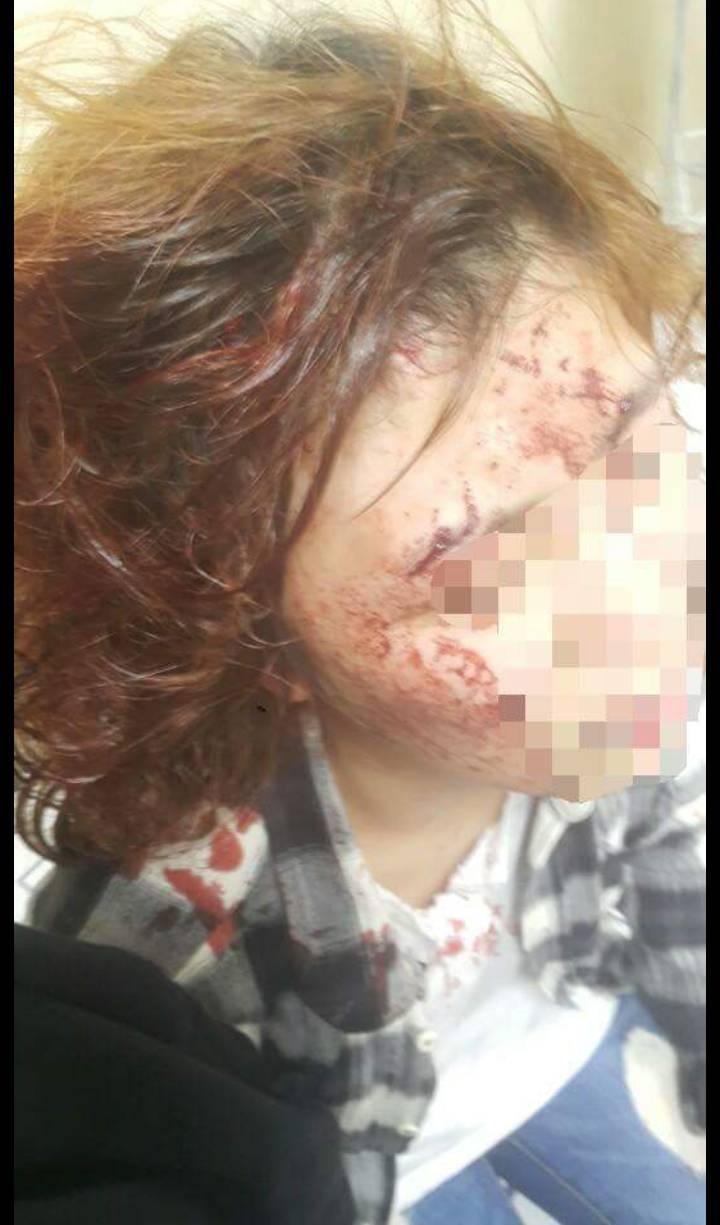 전남친 이랑 말 몇마디했다고 여친 폭행한 미(피흘리는 사진있음) | 인스티즈