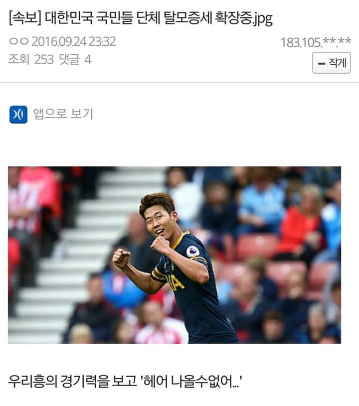 [속보] 대한민국 국민들 단체 탈모증세 확장중 | 인스티즈