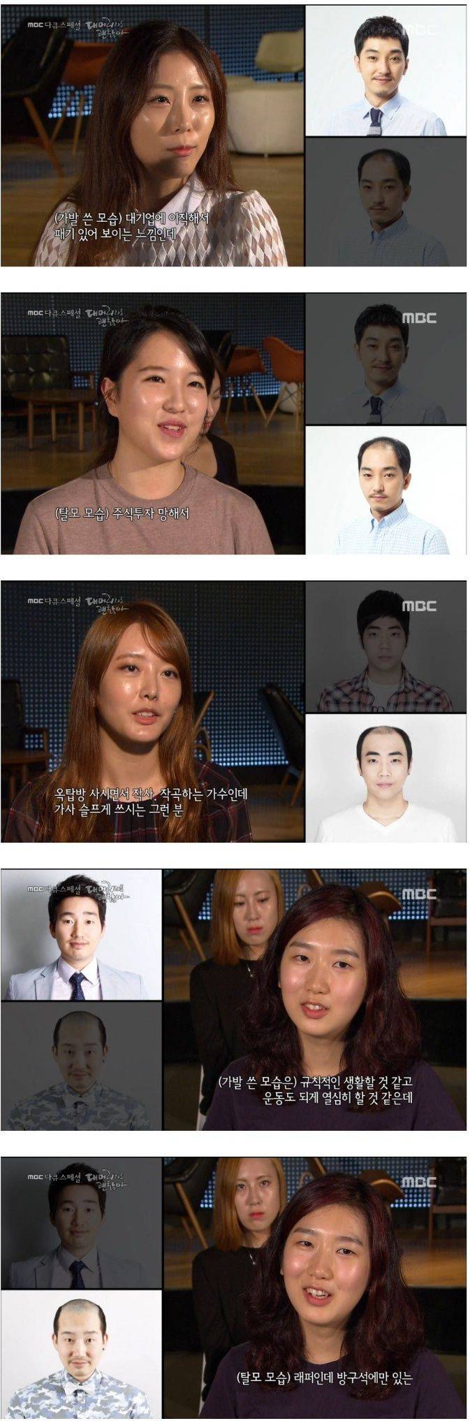 탈모인을 바라보는 여성들의 시선 | 인스티즈