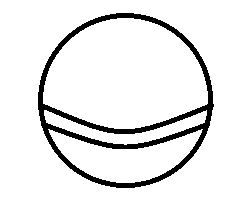 유전성 탈모이신분들에게 조언글하나... | 인스티즈