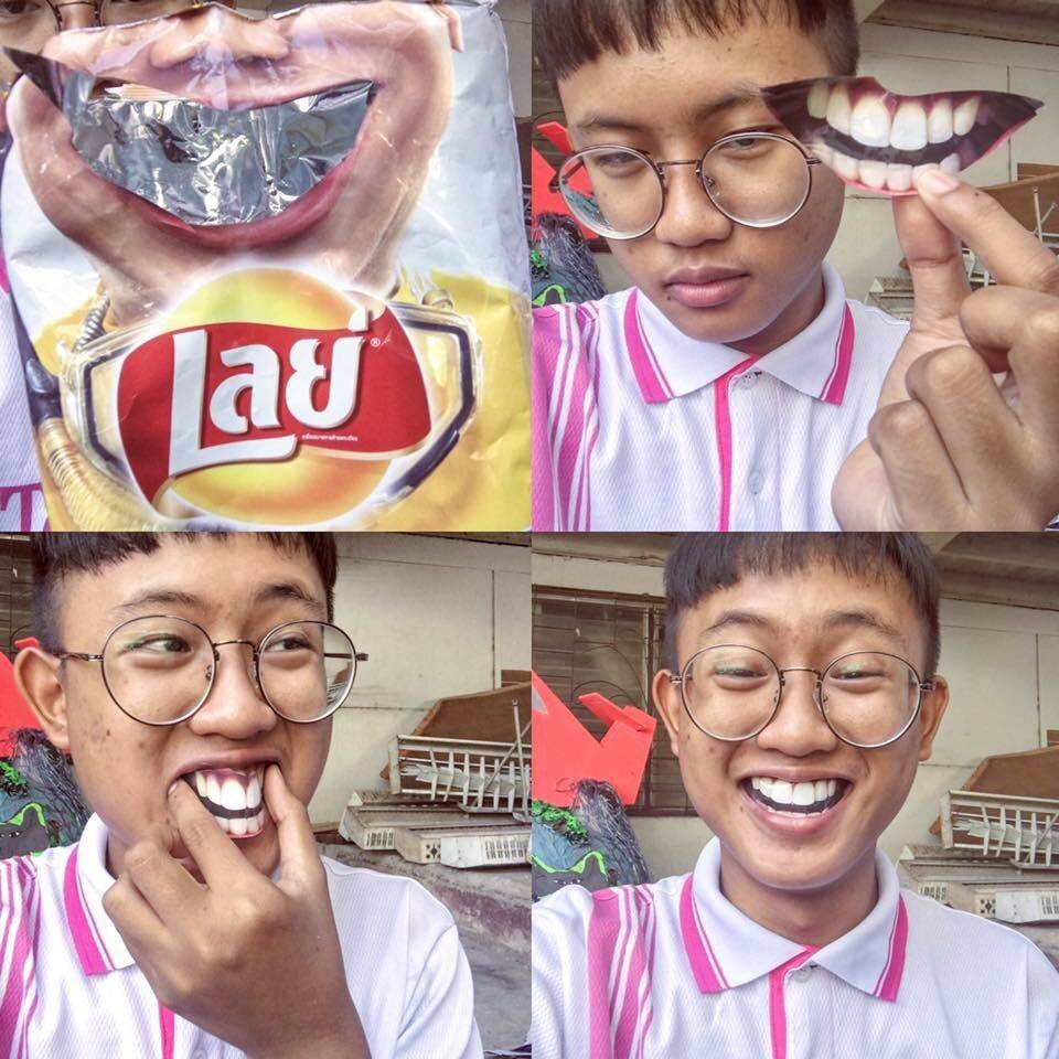 치과에갈 돈이 없을때... | 인스티즈