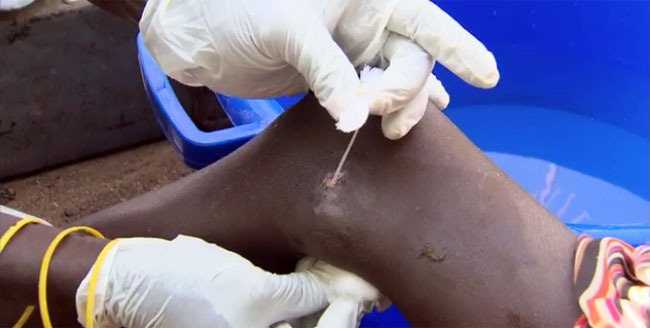 숙주가 필요한 기생충들 | 인스티즈