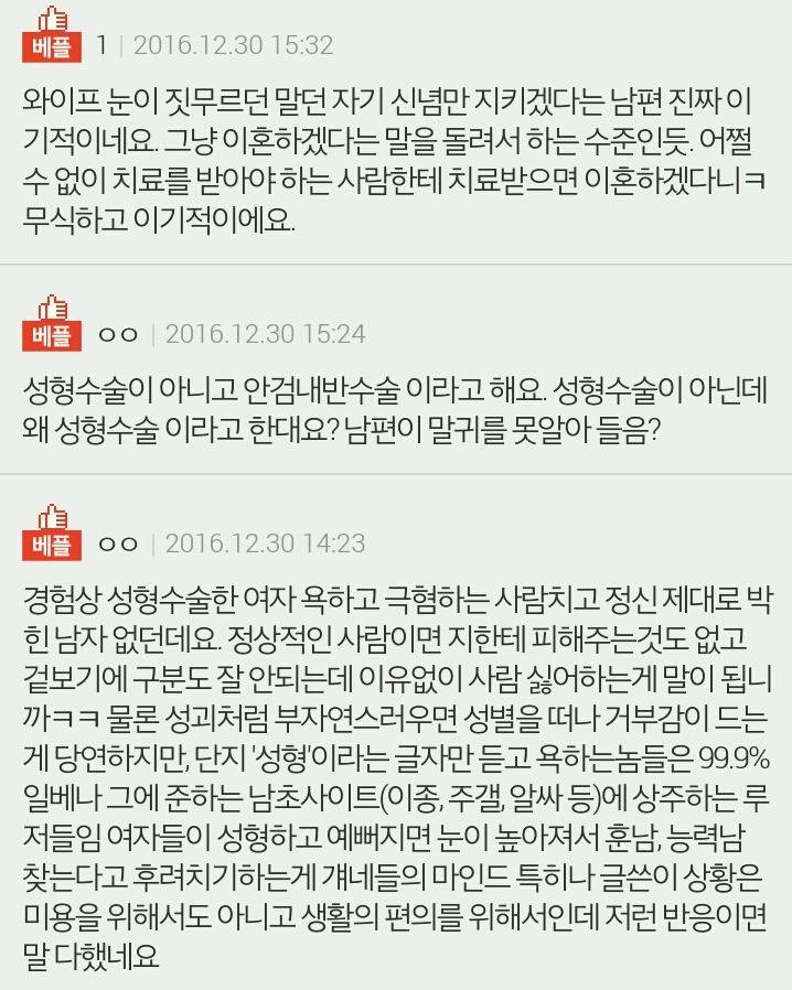 성형하면 이혼이라는 남편 | 인스티즈