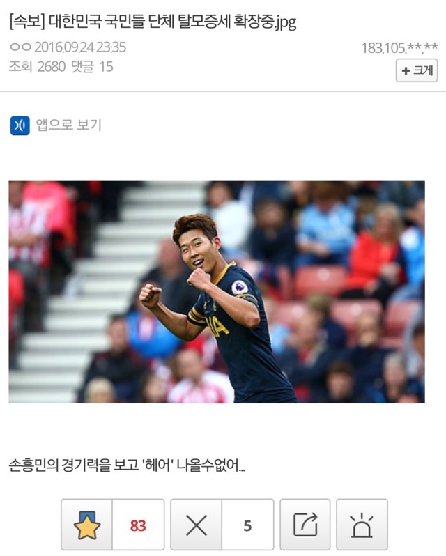 [속보] 대한민국 국민들 단체 탈모현상 | 인스티즈