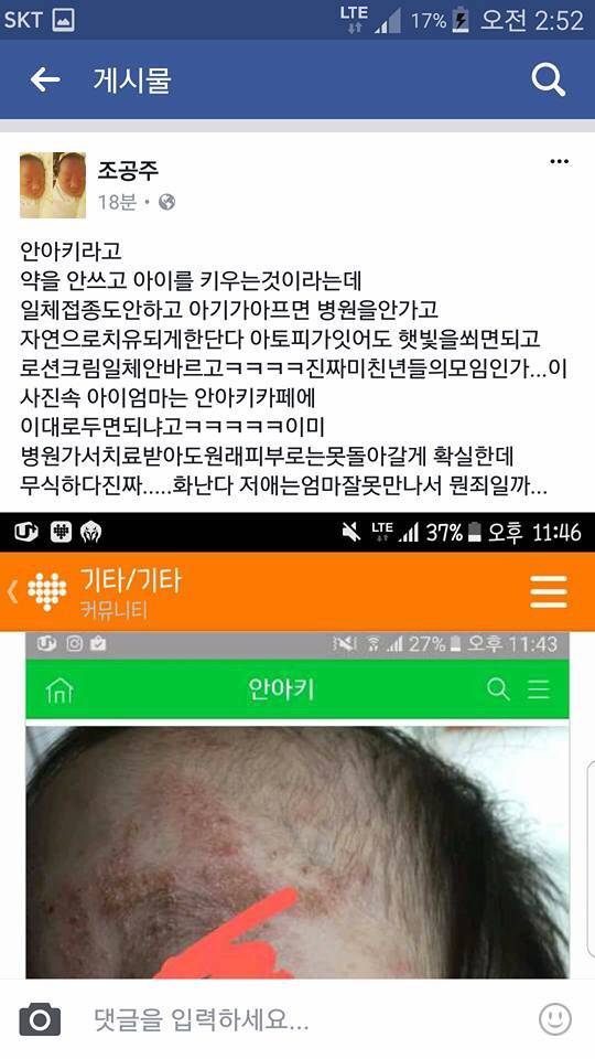 아기 약 안먹이고 자연 치유 시키는 안아키 라는 카페 (혐오주의) | 인스티즈