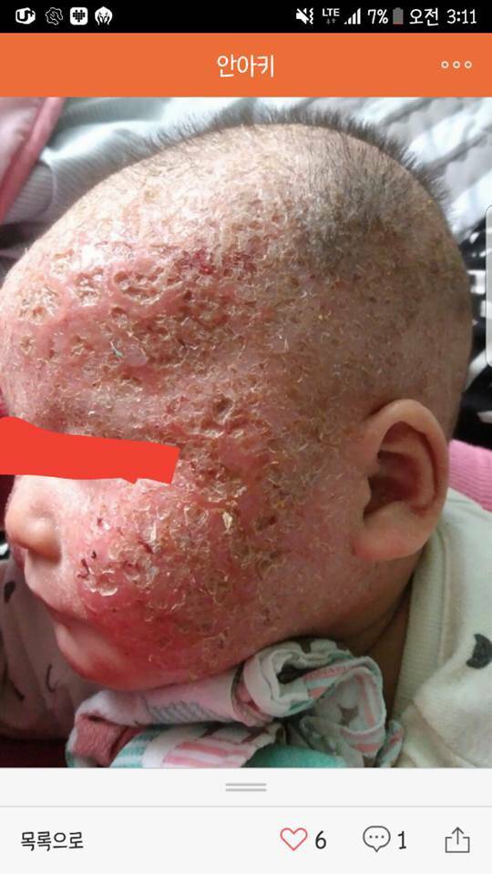 아기 약 안먹이고 자연 치유 시키는 안아키 라는 카페 (혐오주의) | 인스티즈