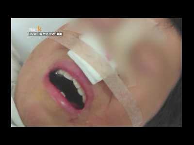 8살 딸이 맞았다고 보복폭행한 아버지. 제발 읽고 오해좀 풀었으면 ㅠㅠ 남자애가 맞을짓 한거 아님 | 인스티즈