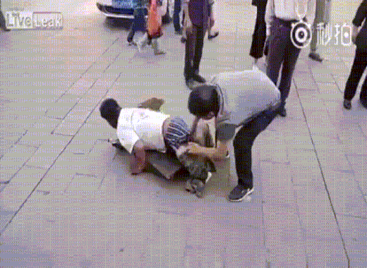 매몰되어있던 왼쪽 다리를 하의절개술로 꺼내준 외과의 | 인스티즈