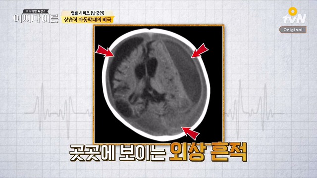 [어쩌다어른] 상습적 아동학대의 비극 | 인스티즈