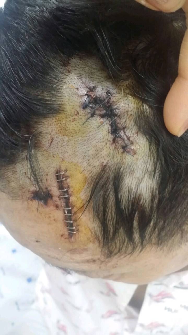 [판] 부모님이 살인청부를 당하셨습니다. (사진 사진조심!!!!주의!!!!!!!!!!!) | 인스티즈