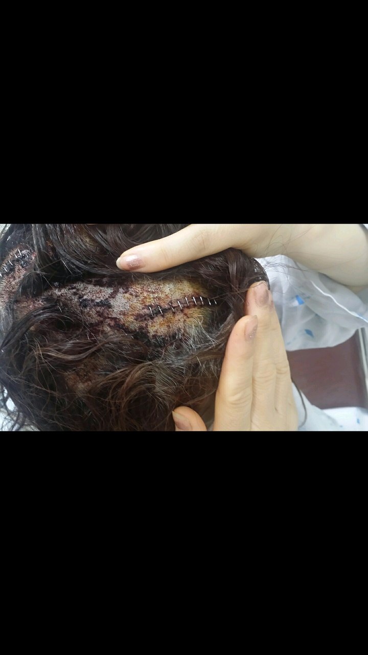 [판] 부모님이 살인청부를 당하셨습니다. (사진 사진조심!!!!주의!!!!!!!!!!!) | 인스티즈