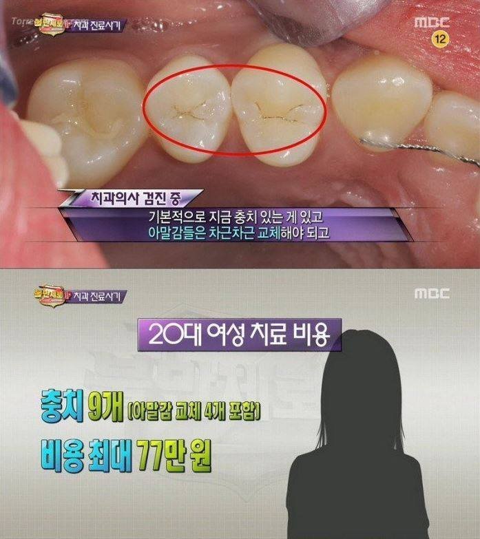 치과 치료의 진실 | 인스티즈