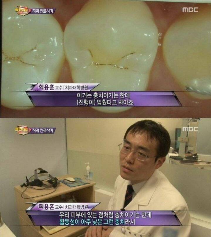 치과 치료의 진실 | 인스티즈