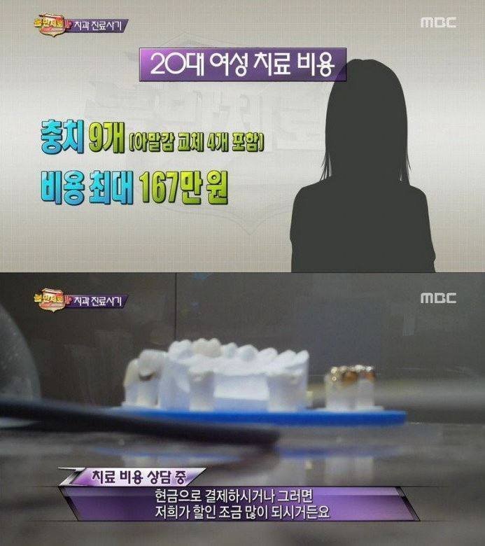 치과 치료의 진실 | 인스티즈