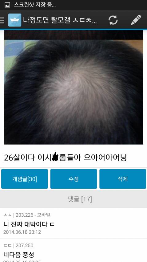 유쾌한 탈모갤 성님들 ㅋㅋㅋㅋㅋㅋㅋㅋㅋㅋㅋㅋㅋㅋㅋ | 인스티즈