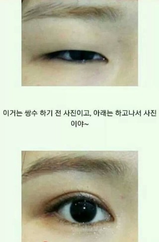 여친이 쌍커풀 수술을 하겠다고 한다면? | 인스티즈