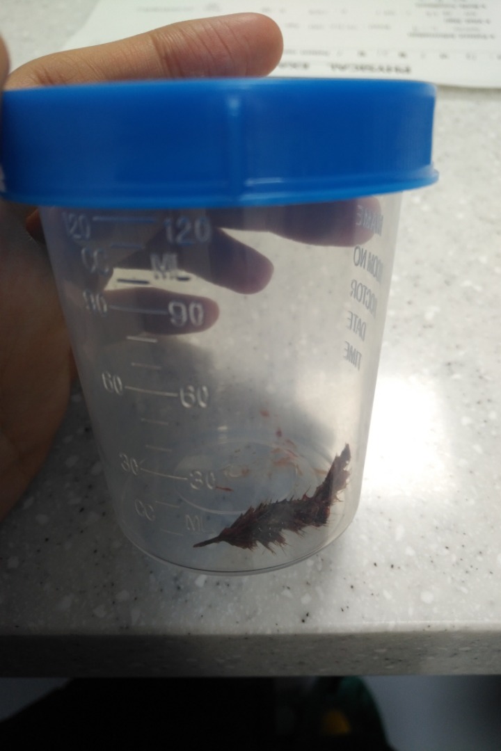 반려동물을 기른다는 것에 대한 현실(feat.매쫑)+댓글에도 여시들이 예시많이 올려주는중...! | 인스티즈