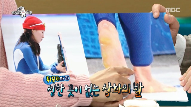 [라디오스타] 어렸을 때 아버지가 발관리 해주셨다는 이상화 (feat.곽윤기) | 인스티즈