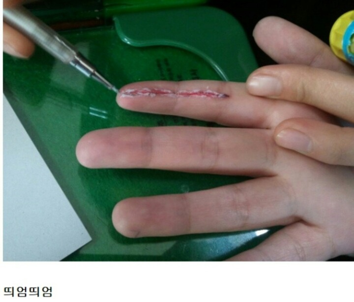 조퇴 쉽게 하는법 | 인스티즈