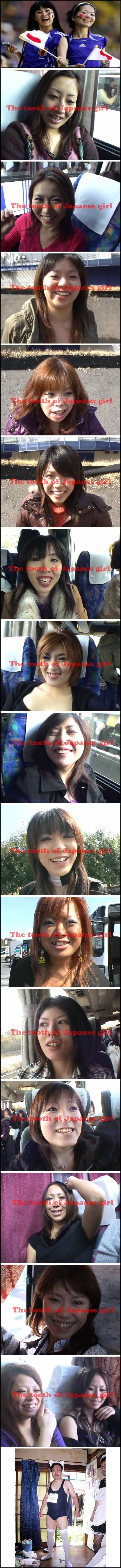  일본인은 왜 덧니가 많은가? | 인스티즈