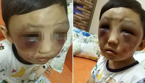 울음소리 시끄러워 항의하러 갔던 옆집 남성이 구조한 '멍투성이' 소년 | 인스티즈