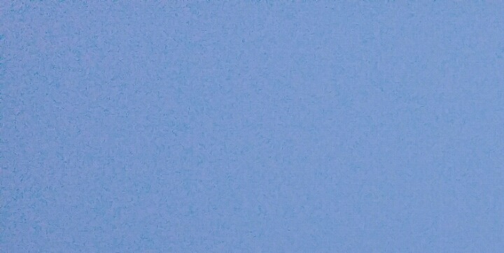 사랑니 발치.gif (혐오주의) | 인스티즈