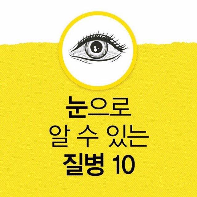 눈으로 알 수 있는 질병 | 인스티즈